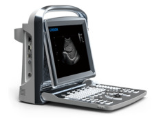 Mesin ultrasound hitam putih Chison