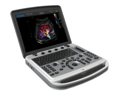 Portativ ultrasəs cihazları Chison